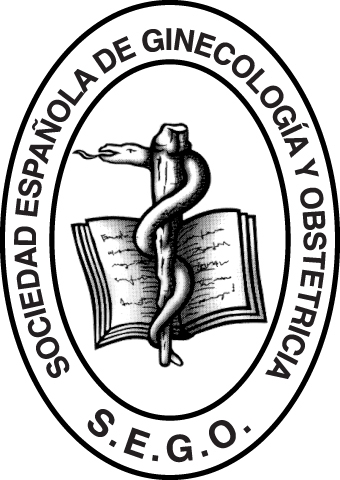 SEGO